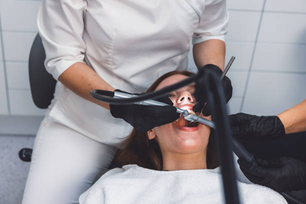 Best Emergency Tooth Extraction in Mclean, VA